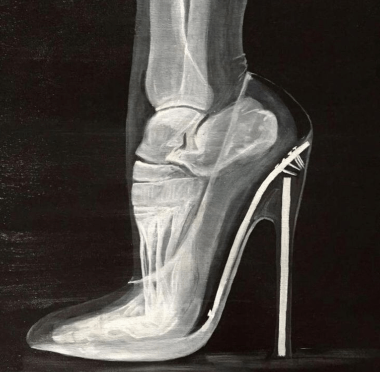 image radiologique de talon